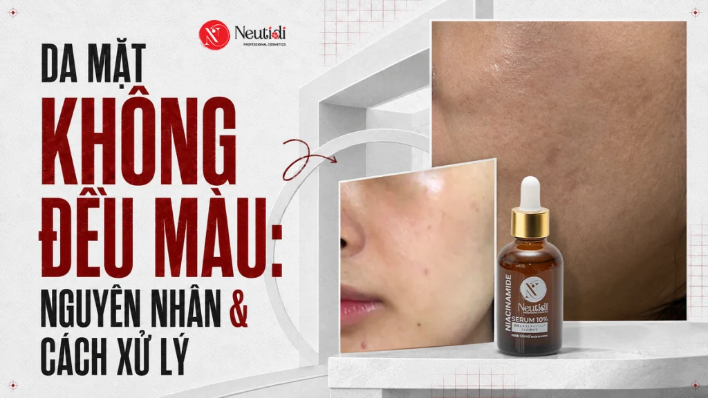 Da mặt không đều màu phải làm sao? Cách chăm sóc đúng hướng 1 Da mặt không đều màu