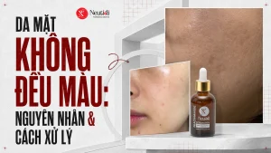 Da mặt không đều màu
