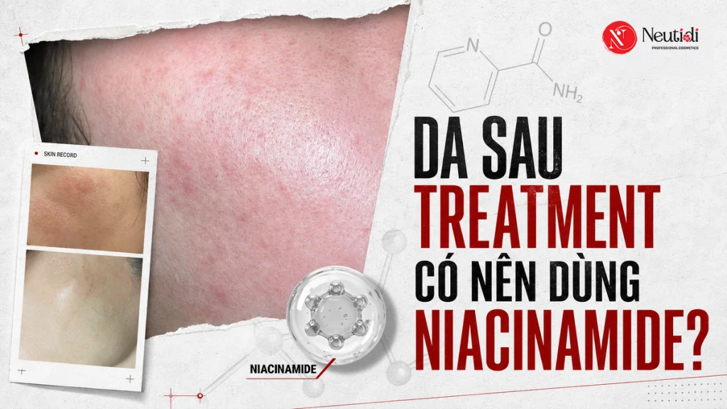 Niacinamide có giúp phục hồi da treatment