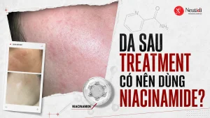 Niacinamide có phục hồi da sau treatment không? 15 Niacinamide có giúp phục hồi da treatment