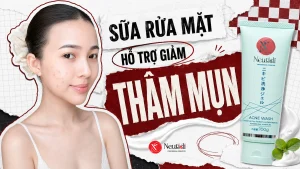 Da thâm mụn dùng sữa rửa mặt gì? Gợi ý 7 sản phẩm kiểm soát thâm hiệu quả 16 TOP sữa rửa mặt trị thâm mụn hiệu quả