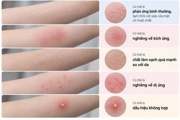 Cách đọc phản ứng của da khi thử sữa rửa mặt