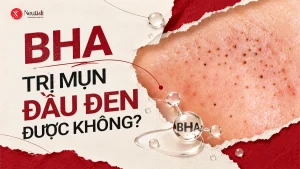 Mẹo dùng BHA trị mụn đầu đen hiệu quả & lưu ý khi dùng 7 Dùng BHA trị mụn đầu đen